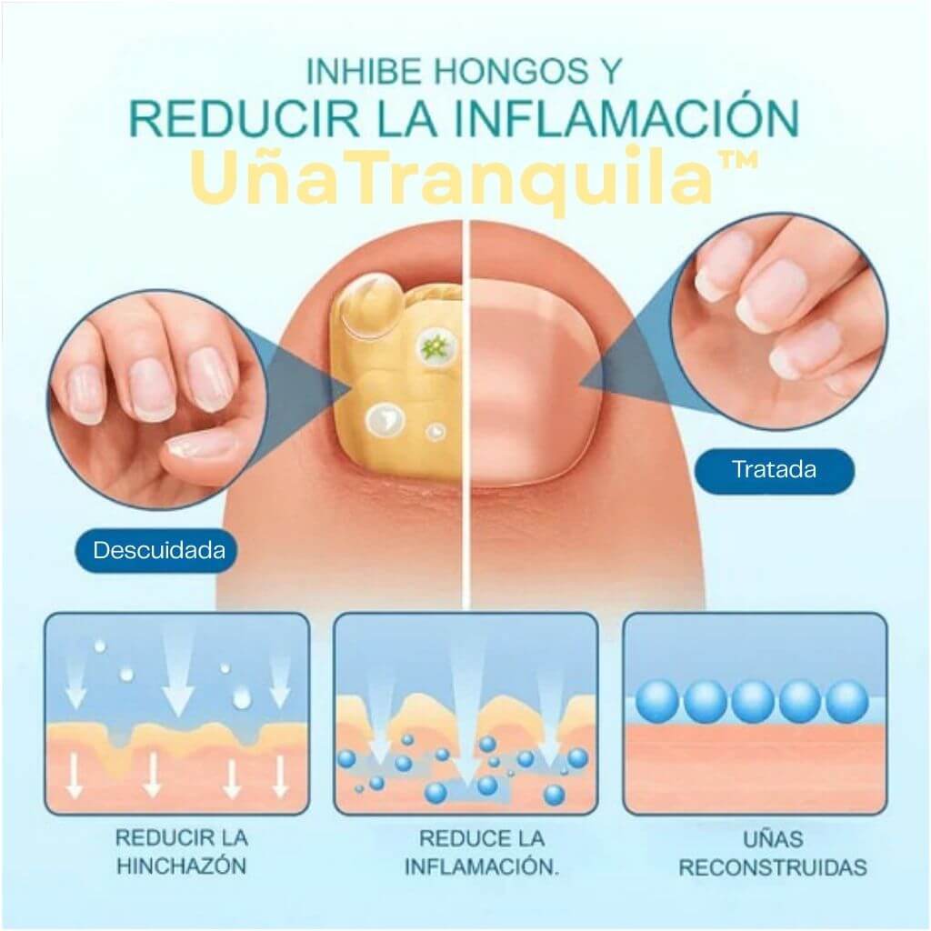 UñaTranquila™ - Cuidado Nocturno para Uñas